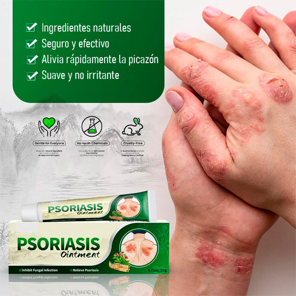 Crema Antifúngica y Antipicazón – Tratamiento Natural para Tiña, Hongos y Psoriasis