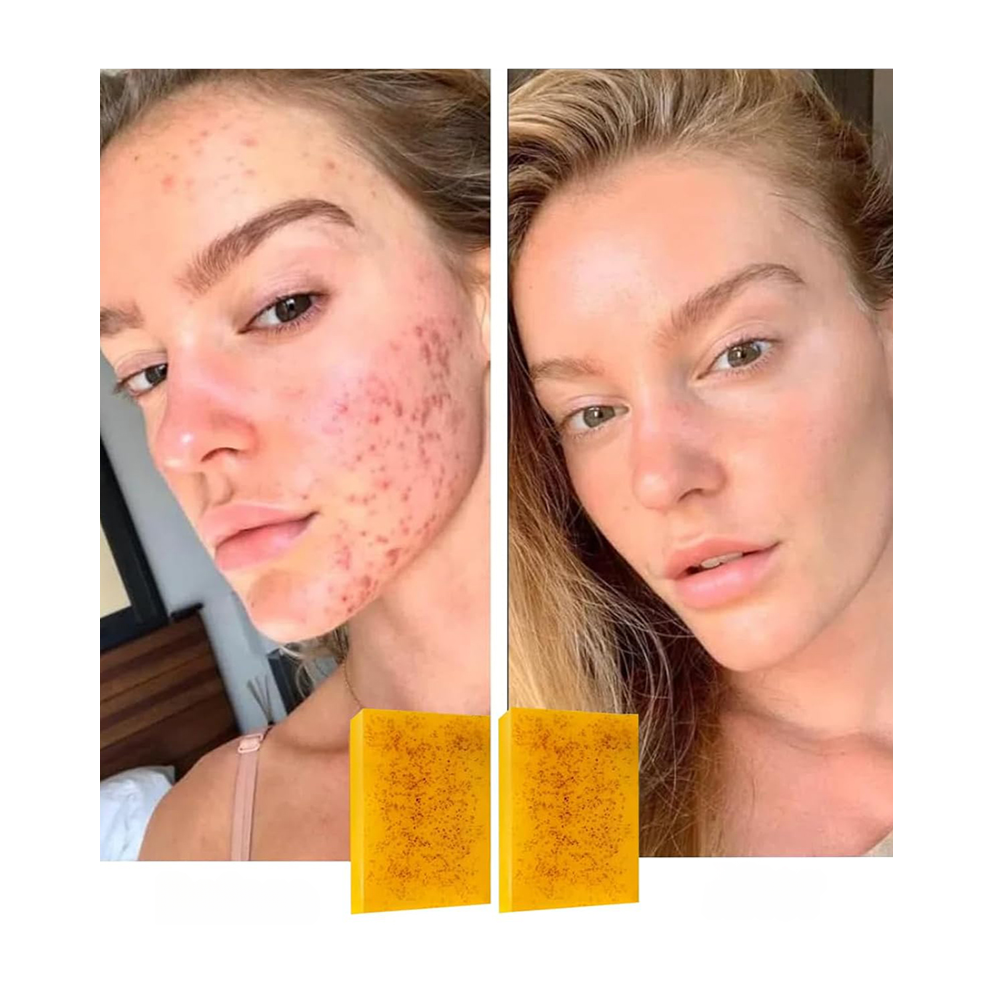 JABON TURMERIC Oro de Luz. 2*1
