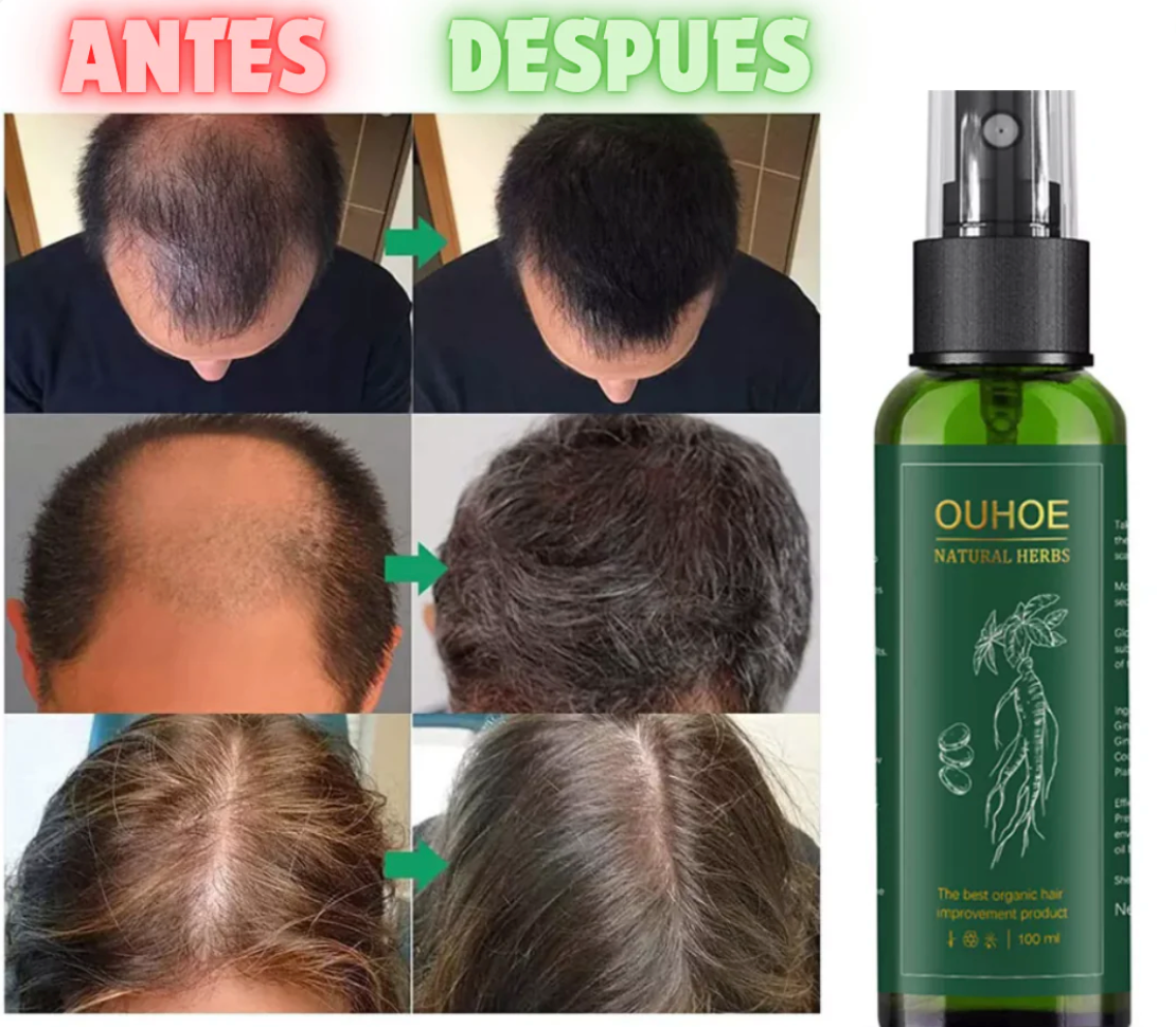 SERUM REVITALIZANTE PARA CRECIMIENTO DE CABELLO OUHOE + ENVIO GRATIS